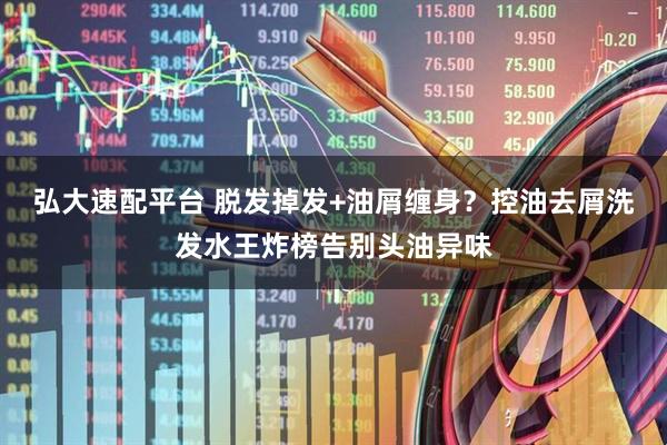 弘大速配平台 脱发掉发+油屑缠身？控油去屑洗发水王炸榜告别头油异味